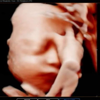 Womb in Bloom 3D/4D/HD Ultrasound